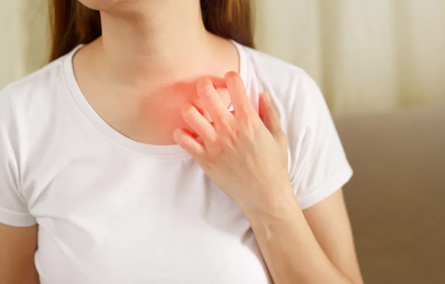 Hudinfektioner under sommaren