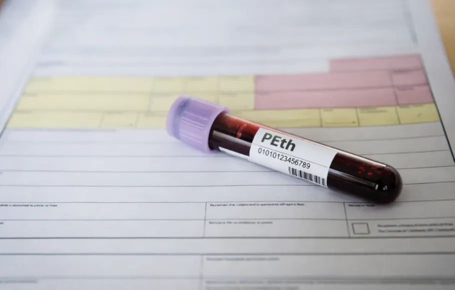Peth-test